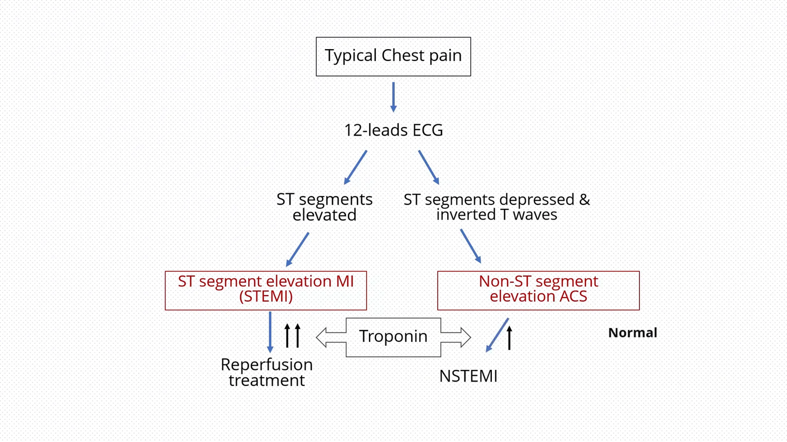 ECG showing changes indicative of myocardial infarction