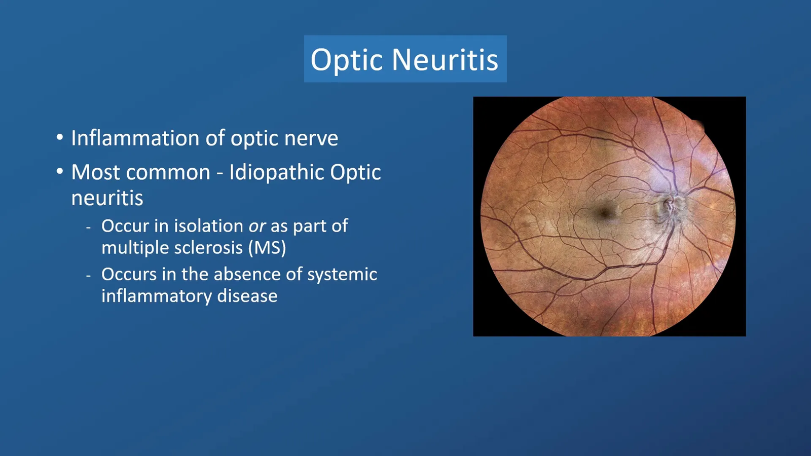סוגים שונים של ניריטיס אופטי