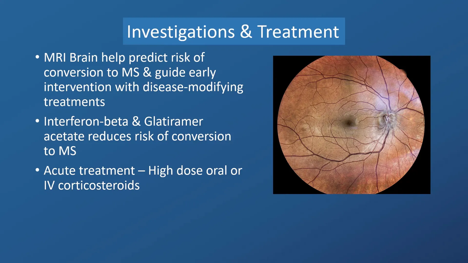 טיפול בסטרואידים לניריטיס אופטי