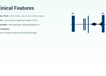 f82a4454 625a 45b2 a3e5 19ee157330e7